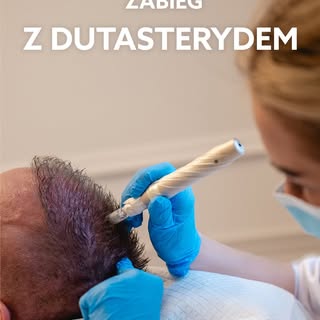 Mikronakłuwanie z dutasterydem to w ostatnim czasie jeden z naszych (i też Waszych) ulubionych zabie