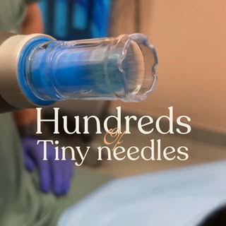 Hundreds of tiny needles. Your skin's best decision. 🎯

Dermapen Microneedling works by creating th