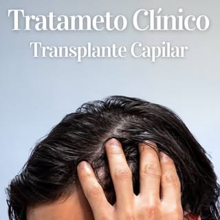 Sabia que o transplante capilar pode piorar e muito a sua queda de cabelo? 🤯

Muita gente não sabe,