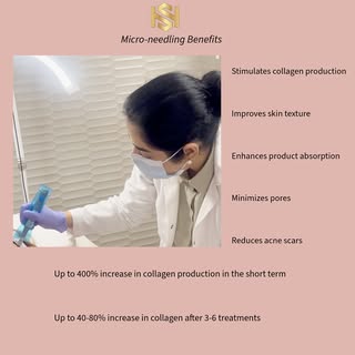 🤍Micro-needling benefits:

🤍Stimulates collagen production up to 400% in short term and 40-80% in 