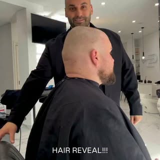 REVEAL TIME !! You guys have been waiting 👀

A massive thank you to Sam at @hairloss_establishment.