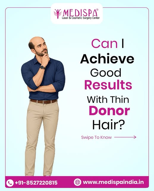 Good Hair Transplant Results with weak Donor Is possible