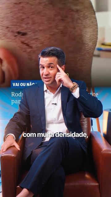 Neste episódio, é avaliado o transplante capilar do prefeito de Sorocaba, Rodrigo Manga, mostrando q