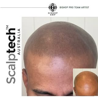 ⭐️ 12years as SMP practitioner/artist
⭐️ FREE Consultation 
⭐️ BISHOP sponsored artist and proud amb
