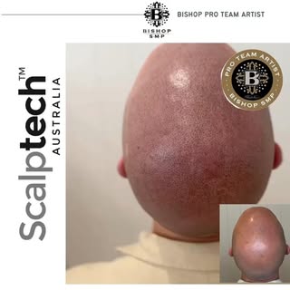 Natural Looking Results are our EXPERIENCE 
⭐️ ⭐️⭐️⭐️⭐️
Zoom in 👀

 12years as SMP practitioner/art