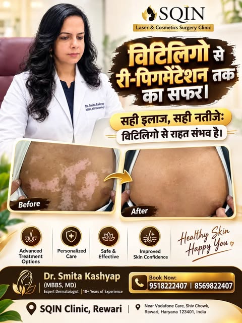✨ Vitiligo se Re-Pigmentation tak — sahi treatment ki taraf ek step! ✨

Vitiligo skin par white patc