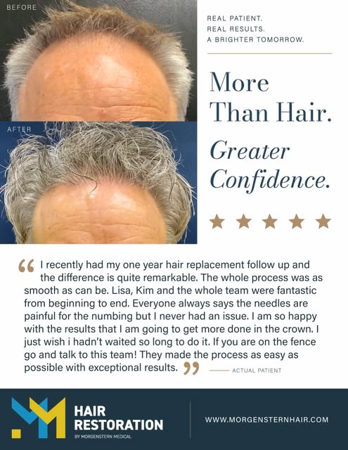 One year later, and the difference speaks for itself.

This patient recently returned for his one-ye