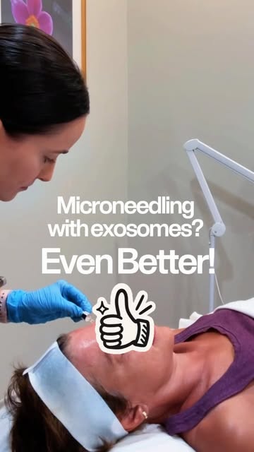 Microneedling alone? Good.
Microneedling with exosomes? Even better! ✨

Microneedling helps stimulat