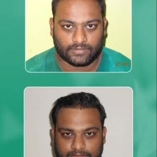 Meet Dr. Nazir, a medical professional who chose to trust us with something deeply personal: his hai