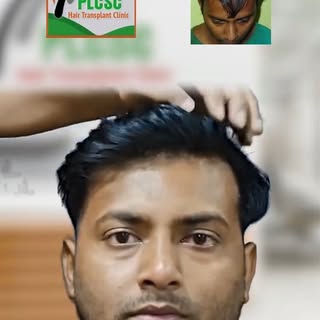 The feedback of Mr. Monoiit after getting hair transplant treatment from our clinic - PLCSC.

For mo