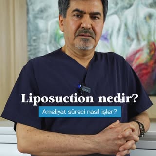 Liposuction, vücuttaki bölgesel yağ birikimlerinin cerrahi yöntemle alınmasını hedefleyen bir vücut 