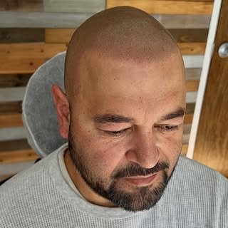 Confidence restored with this touch up ✅

@scalpmicro_usa 
@folicule 

#scalpmicropigmentation #scal