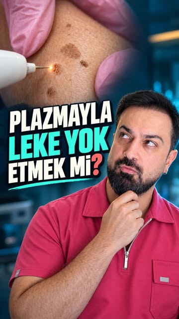 #leketedavisi #lazerleleketedavisi #lekeserumu #melazmatedavisi