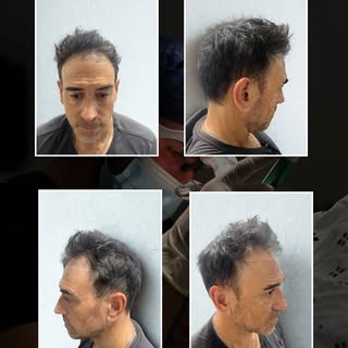 12 MONTH TRANSFORMATION 

Check out this patients transformation - this patient had been experiencin