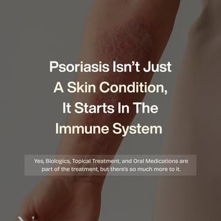 The truth about psoriasis nobody talks about 🔍

Swipe through to understand the connection between 