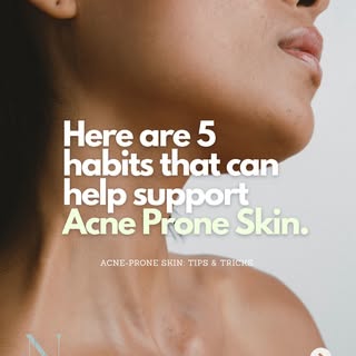 5 Habits For Acne-Prone Skin ➡️

✨ Simple habits can make a big difference when it comes to managing