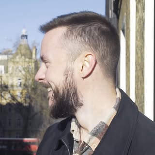 12 months ago we welcomed Chris into Westminster Medical Group for an FUE hair transplant. 

On that