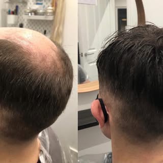 MENS HAIR REPLACEMENT

@florescence_aberdeen 

#hairlosssolution #hairtransformation #menshairloss #