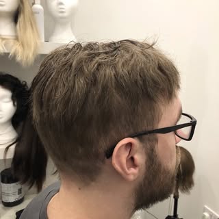 After Men’s hairloss system fitted , the difference is so amazing , another very happy client