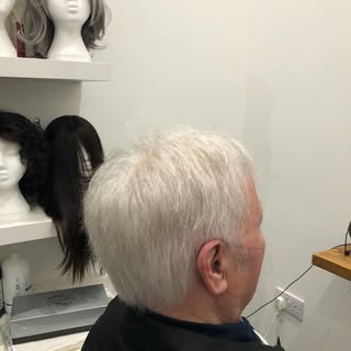 Men’s hair replacement system, before & after

@florescence_aberdeen