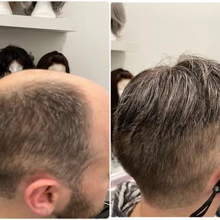 Mens non surgical hair replacement.

For consultations get in touch to book. @kimcandy_hairstylist @