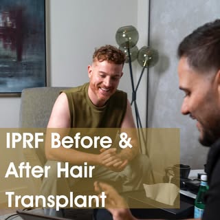 “Thinking about a hair transplant? Here’s why I-PRF (Injectable Platelet-Rich Fibrin) is a game-chan