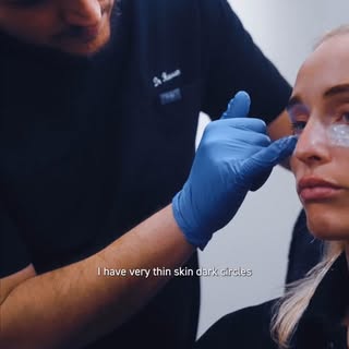 Dark circles aren’t just about being tired — they’re often caused by a combination of anatomy, skin 