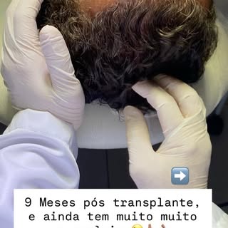 💬 O resultado de um transplante vai muito além da cirurgia — ele é fruto de parceria entre paciente
