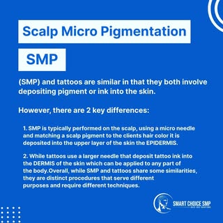 Scalp micropigmentation (SMP) and tattoos are different procedures, although they may share some sim