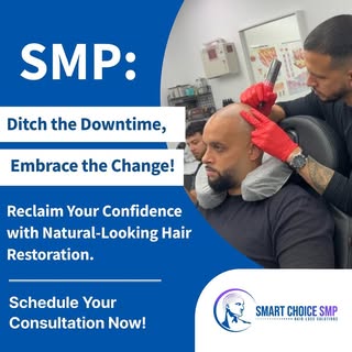 Various forms of hair loss affect both men and women. Male and female pattern hair loss are among th