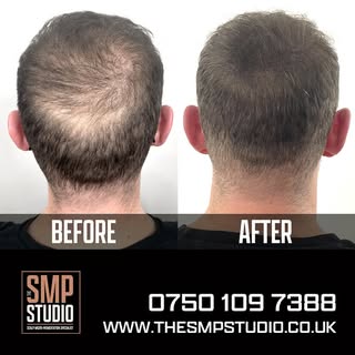 BEFORE AND AFTER.
Client happy with the last session. 
•
Density work on a man who’s already had a t