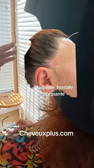 🌿 Le témoignage de notre cliente

Pendant plusieurs années, notre cliente a été confrontée à une pr