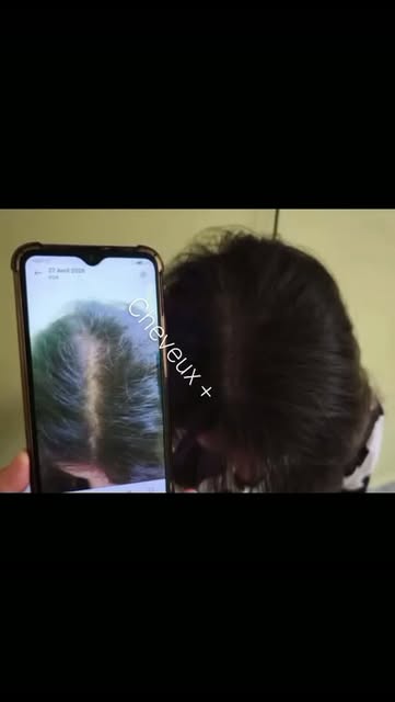 AVANT/APRÈS 
Une cliente, un protocole, des résultats visibles.
Chez Cheveux+, on ne traite pas la c