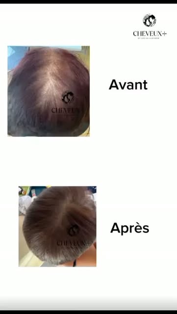 ✨ Avant / après ✨
Le résultat du protocole de soins suivi par notre cliente chez Cheveux+ by Sakina 