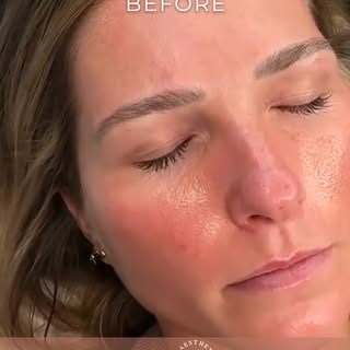 Eyebrow Colour Boost After 2 Years

A fresh colour boost to revive and refresh the brows after two y