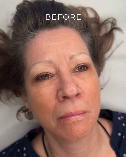 Nanoblading Before & After 🤩

A little brow transformation goes a long way.

Fine, natural-looking 