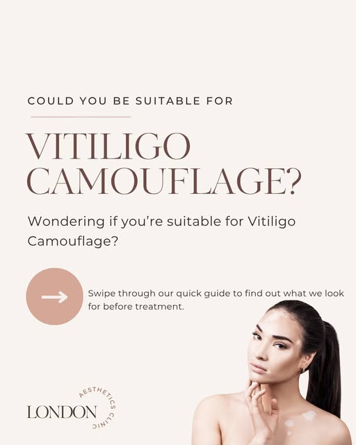 Thinking about vitiligo camouflage? 👀

Before you book, there are 4 important things you need to kn