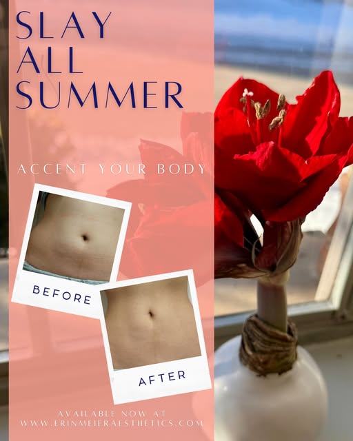 🔥 Slay All Summer with Accent 🔥

Feel confident in your skin all season long. The non-invasive Acc