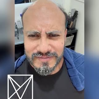 Que nuestro sistema capilar premium te cambia la vida? La respuesta es SI.

La apariencia que te dan