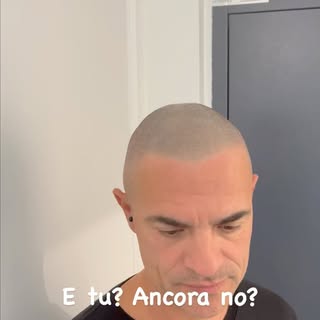 Se sei stanco di apparire calvo …
Il mio trattamento di Tricopigmentazione ti aiuterà a riconquistar
