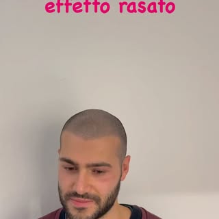 Addio alla calvizie con la tricopigmentazione info whatsapp 348/0455653