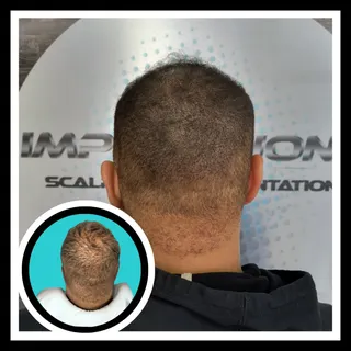 Yes - We can add density to longer hair!
📱Call or text 716-465-9955 to find out if you're a good ca