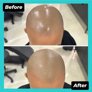 Scalp shiny?  Grab a tube of Xone Mattifier and tone it down! @xonemattifier
Order at Xonemattifier.