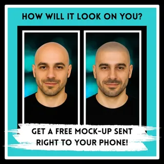 Curious about your restored hairline? Send your picture our way and receive a personalized digital t