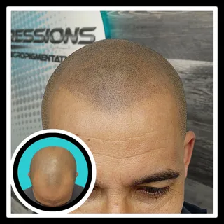 A natural look for this middle aged client! 

#scalpmicropigmentation #smp #menshair #hairtattoo #ha