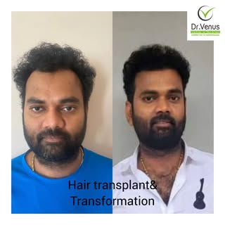 "✨ Witness the incredible transformation of our dear celebrity client, Ram Prasad garu✨️
Thank for g