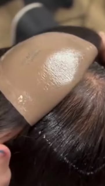 Hair extensions aren’t the right solution for every type of hair loss but that doesn’t mean you’re o