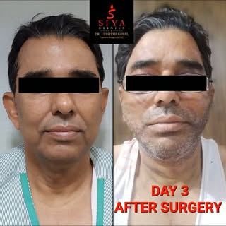 The Architecture of Youth: Comprehensive Face & Neck Rejuvenation in Just 2 Days 📐✨

​Look closely 