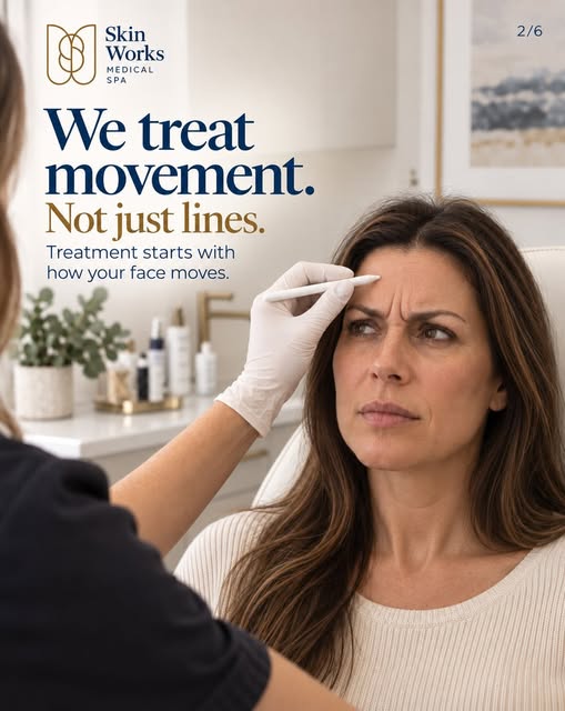 Good Botox should still look like you.

The goal is not to erase every line or make every forehead b
