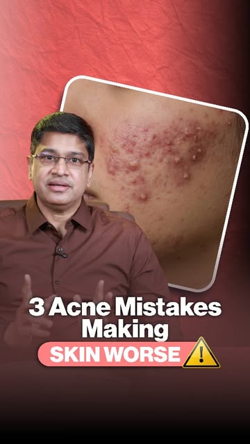 Stop making your acne worse! 🚫
Before you pick that pimple or try another viral DIY hack, watch thi